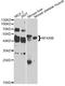 NFKB Inhibitor Beta antibody, A5777, ABclonal Technology, Western Blot image 