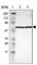 Chaperonin Containing TCP1 Subunit 5 antibody, HPA002238, Atlas Antibodies, Western Blot image 