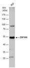 Zinc Finger Protein 556 antibody, PA5-36014, Invitrogen Antibodies, Western Blot image 
