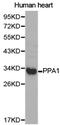 Pyrophosphatase (Inorganic) 1 antibody, LS-C192868, Lifespan Biosciences, Western Blot image 