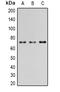 P21 (RAC1) Activated Kinase 4 antibody, GTX32289, GeneTex, Western Blot image 