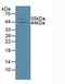 Matrix Metallopeptidase 13 antibody, LS-C299941, Lifespan Biosciences, Western Blot image 