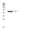 Keratin 14 antibody, STJ98650, St John