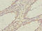 Centrosomal Protein 95 antibody, LS-C675511, Lifespan Biosciences, Immunohistochemistry paraffin image 
