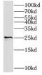 Transporter 2, ATP Binding Cassette Subfamily B Member antibody, FNab06854, FineTest, Western Blot image 