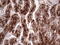 Cyclin Dependent Kinase Like 2 antibody, M11432, Boster Biological Technology, Immunohistochemistry paraffin image 