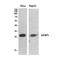Insulin Like Growth Factor Binding Protein 3 antibody, A00435, Boster Biological Technology, Western Blot image 