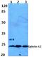 Ephrin A2 antibody, A09844-1, Boster Biological Technology, Western Blot image 