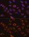 Discs Large MAGUK Scaffold Protein 1 antibody, GTX64496, GeneTex, Immunocytochemistry image 
