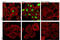 Cyclin D1 antibody, 3300T, Cell Signaling Technology, Immunofluorescence image 