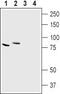 Chloride Voltage-Gated Channel 7 antibody, GTX00817, GeneTex, Western Blot image 