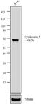 Keratin 5 antibody, MA5-12596, Invitrogen Antibodies, Western Blot image 