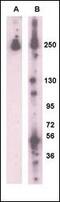 Leucine Rich Repeat Kinase 2 antibody, MBS9205676, MyBioSource, Western Blot image 