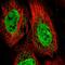 Troponin C2, Fast Skeletal Type antibody, HPA058481, Atlas Antibodies, Immunofluorescence image 