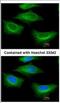 Tubulin Beta 2A Class IIa antibody, NBP2-15580, Novus Biologicals, Immunocytochemistry image 