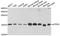 ATP Synthase F1 Subunit Delta antibody, A9929, ABclonal Technology, Western Blot image 