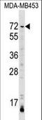 Adhesion Molecule With Ig Like Domain 3 antibody, LS-C161051, Lifespan Biosciences, Western Blot image 