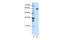 Heterogeneous Nuclear Ribonucleoprotein L Like antibody, 29-492, ProSci, Immunohistochemistry frozen image 