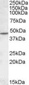 Cholinergic Receptor Nicotinic Beta 2 Subunit antibody, MBS421737, MyBioSource, Western Blot image 