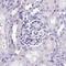 Sperm Acrosome Associated 1 antibody, PA5-60314, Invitrogen Antibodies, Immunohistochemistry paraffin image 