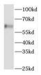 Fibroblast Growth Factor Binding Protein 3 antibody, FNab03098, FineTest, Western Blot image 