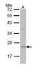 Ferritin Light Chain antibody, PA5-29599, Invitrogen Antibodies, Western Blot image 