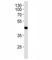 Absent In Melanoma 2 antibody, F53796-0.1ML, NSJ Bioreagents, Western Blot image 