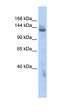 Zinc Finger MYND-Type Containing 8 antibody, orb324583, Biorbyt, Western Blot image 