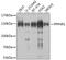 Protein Phosphatase 4 Regulatory Subunit 1 antibody, 23-534, ProSci, Western Blot image 