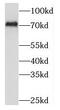 7SK snRNA methylphosphate capping enzyme antibody, FNab05127, FineTest, Western Blot image 