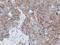 Ras-like without CAAX protein 2 antibody, GTX83710, GeneTex, Immunohistochemistry paraffin image 