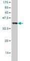 Homeodomain Interacting Protein Kinase 2 antibody, H00028996-M01, Novus Biologicals, Western Blot image 