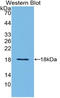 Transthyretin antibody, LS-C314609, Lifespan Biosciences, Western Blot image 