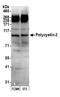 Polycystin 2, Transient Receptor Potential Cation Channel antibody, A302-470A, Bethyl Labs, Western Blot image 