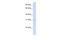 Retinol dehydrogenase 12 antibody, A05127, Boster Biological Technology, Western Blot image 