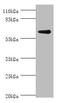 Glycerol kinase 2 antibody, A50257-100, Epigentek, Western Blot image 