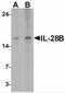 Interferon Lambda 3 antibody, NBP2-41236, Novus Biologicals, Western Blot image 