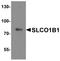 Solute Carrier Organic Anion Transporter Family Member 1B1 antibody, A01375-1, Boster Biological Technology, Western Blot image 
