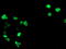 General Transcription Factor IIF Subunit 1 antibody, M08313-1, Boster Biological Technology, Immunofluorescence image 