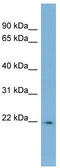 Ladybird Homeobox 2 antibody, TA342401, Origene, Western Blot image 