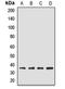 Eukaryotic Translation Initiation Factor 4E Binding Protein 2 antibody, LS-C668213, Lifespan Biosciences, Western Blot image 