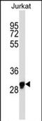 Olfactory Receptor Family 1 Subfamily N Member 1 antibody, PA5-71849, Invitrogen Antibodies, Western Blot image 