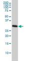 Cyclin Dependent Kinase 1 antibody, H00000983-M01, Novus Biologicals, Western Blot image 