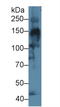 Collagen Type IV Alpha 3 Chain antibody, LS-C693567, Lifespan Biosciences, Western Blot image 