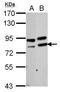 Poly(A)-Specific Ribonuclease antibody, GTX115020, GeneTex, Western Blot image 