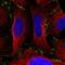 Ectodysplasin A2 Receptor antibody, HPA054522, Atlas Antibodies, Immunocytochemistry image 