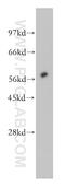 Amylase Alpha 2B (Pancreatic) antibody, 12540-1-AP, Proteintech Group, Western Blot image 