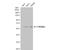 Cytochrome P450 Family 26 Subfamily A Member 1 antibody, NBP2-16061, Novus Biologicals, Western Blot image 