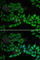 Thiopurine S-Methyltransferase antibody, A1017, ABclonal Technology, Immunofluorescence image 