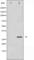 BCL2 antibody, abx012120, Abbexa, Western Blot image 